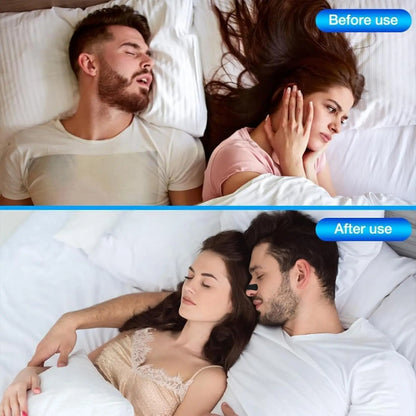 Breathable Anti-Snoring Nose Strips - Nasal Patches for Improved Breathing and Better Sleep