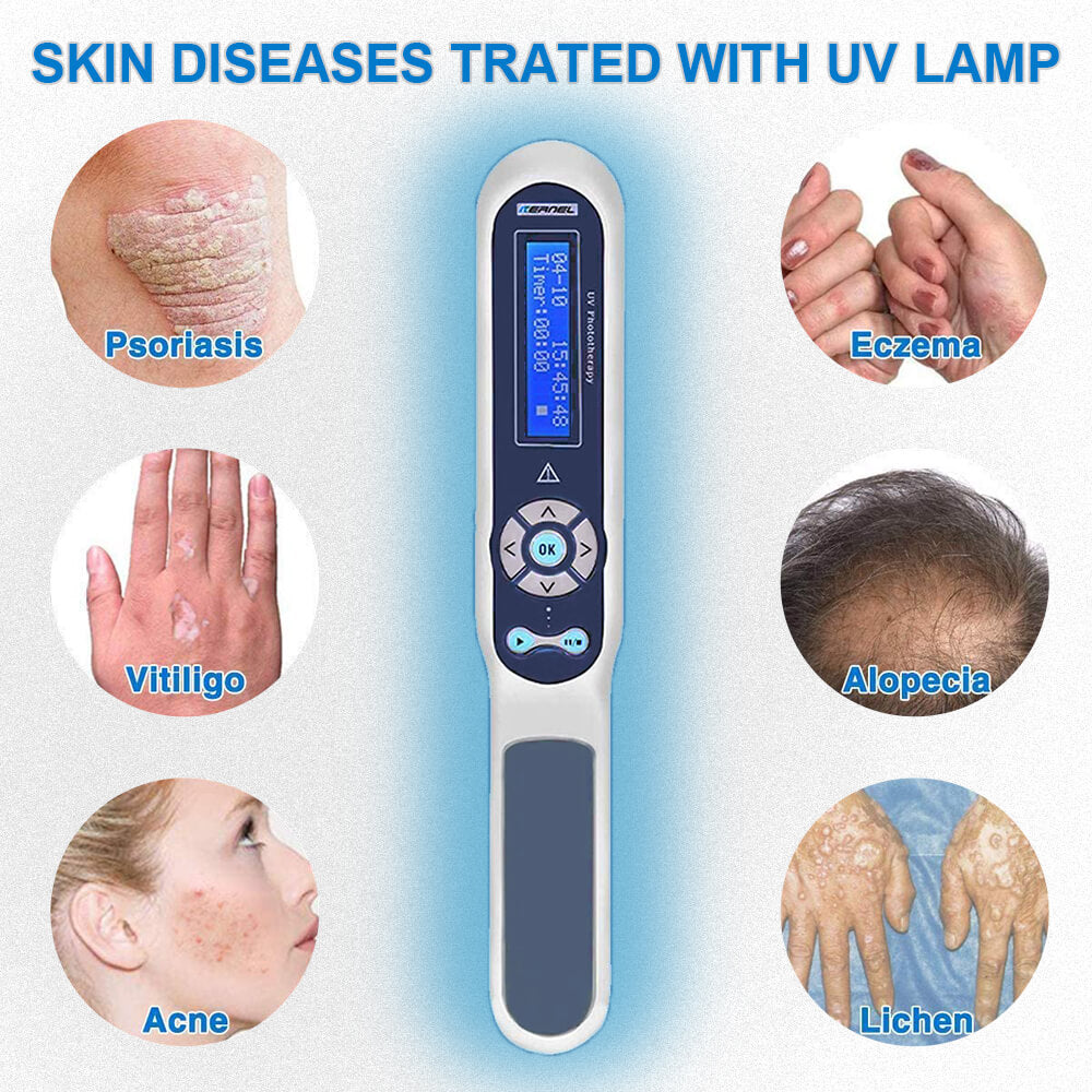 Ultraviolet Disinfection UVB Lamp for Vitiligo, Dermatitis. KN-4003BL, or Psoriasis Eczema other Skin Problem