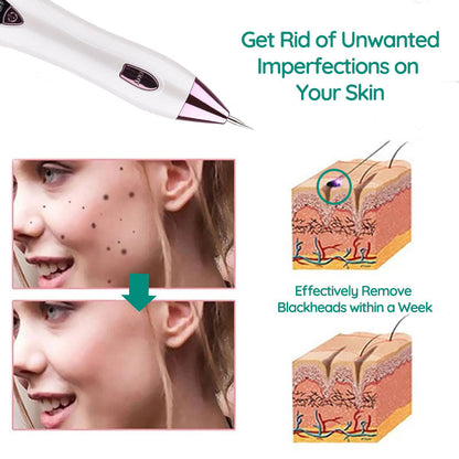 Remover Pen for Moles, Plasma pen, for Mole & Skin Tag & wart Removal, Mole Skin