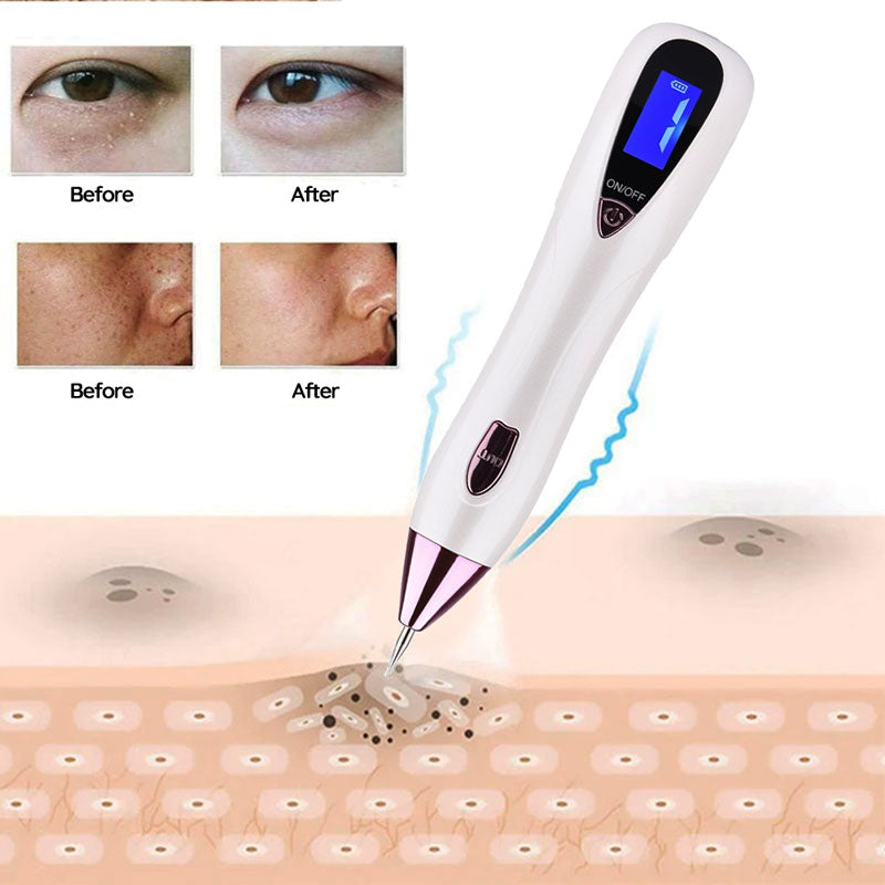 Remover Pen for Moles, Plasma pen, for Mole & Skin Tag & wart Removal, Mole Skin