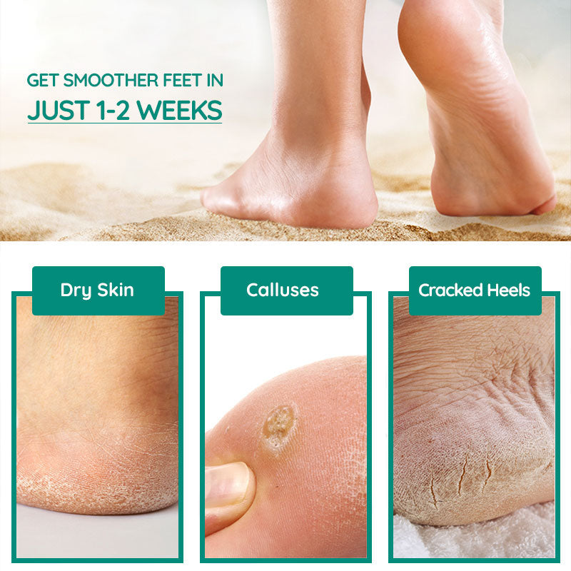 SpaSlippers Awesome Foot Scrubber, Exfoliating Sandal Brush