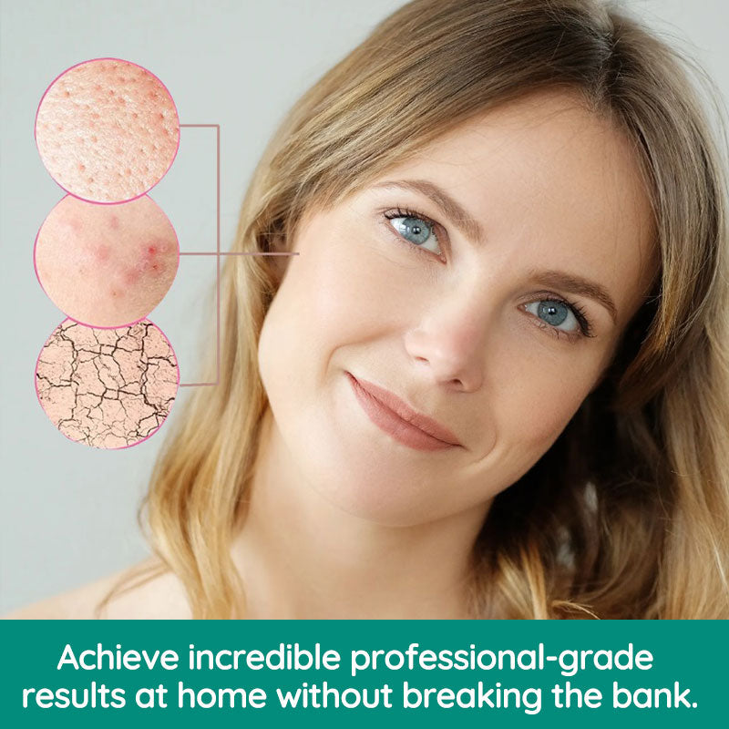 Remover Pen for Moles, Plasma pen, for Mole & Skin Tag & wart Removal, Mole Skin